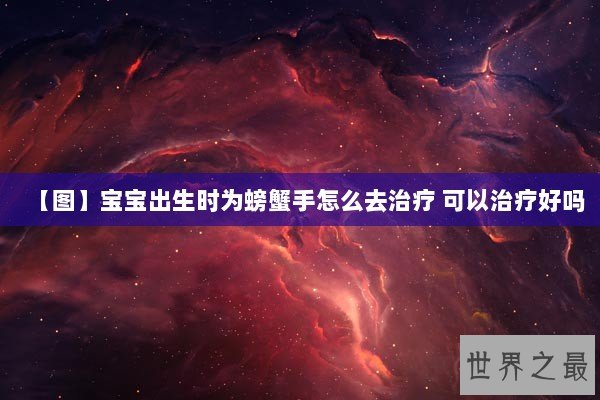 【图】宝宝出生时为螃蟹手怎么去治疗 可以治疗好吗 【图】宝宝出生时为螃蟹手怎么去治疗 可以治疗好吗
