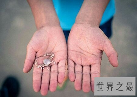 【图】宝宝出生时为螃蟹手怎样去治疗 可能治疗好吗