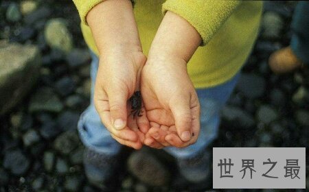 【图】宝宝出生时为螃蟹手怎样去治疗 可能治疗好吗