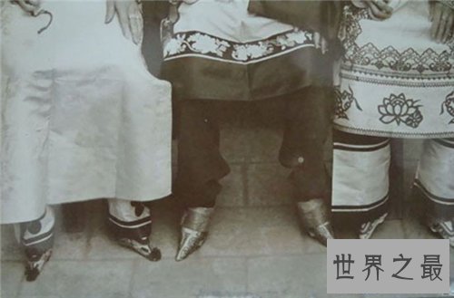 【图】缠足图片畸形吓人 缠足对女性损伤有多大
