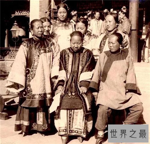 【图】缠足图片畸形吓人 缠足对女性损伤有多大