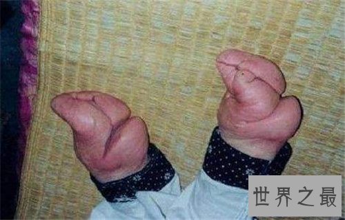 【图】桂平挖蛇事情回忆 4米长白蛇被雷劈死