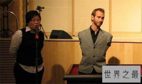 【图】海豹人是什么意思 澳洲曾有某男性天生为海豹人