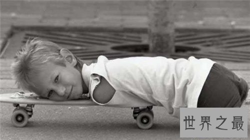 【图】海豹人是什么意思 澳洲曾有某男性天生为海豹人