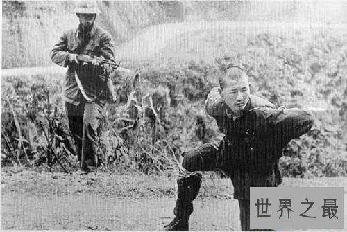 【图】海豹人是什么意思 澳洲曾有某男性天生为海豹人