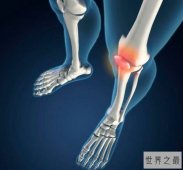 【图】世界五大绝症 人们却对其中一种忽视不见