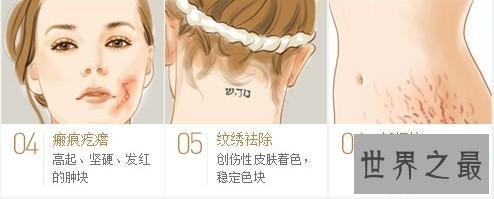 【图】年轻时留下的疤痕让人超级悔恨 怎么祛疤最有效