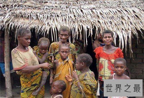 【图】俾格米人的特点生存引见 非洲森林里的袖珍民族