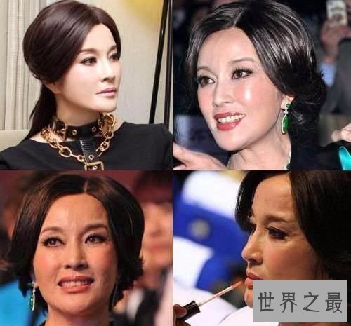 【图】整容失败的明星有哪些 文娱圈整容可谓粗茶淡饭