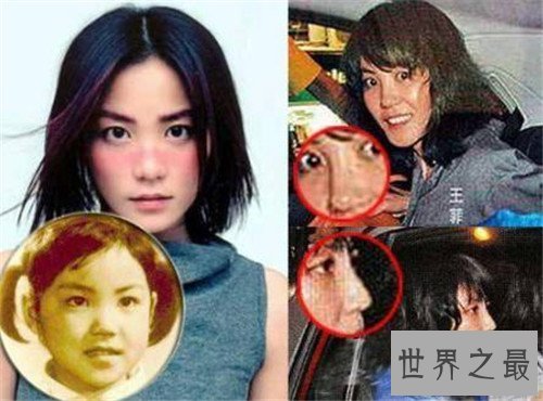 【图】整容失败的明星有哪些 文娱圈整容可谓粗茶淡饭