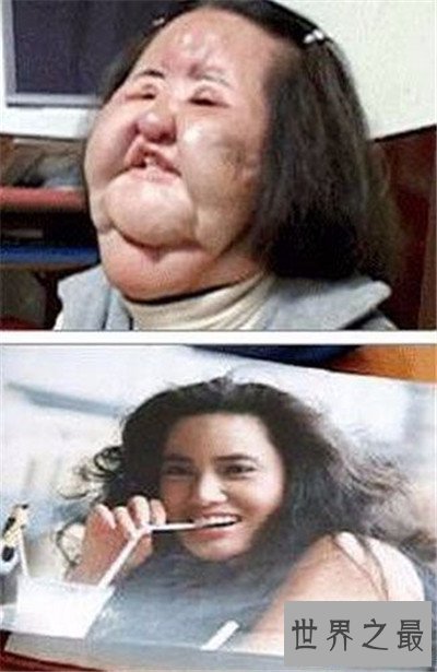 【图】整容失败的明星有哪些 文娱圈整容可谓粗茶淡饭