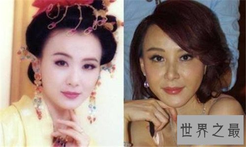 【图】整容失败的明星有哪些 文娱圈整容可谓粗茶淡饭