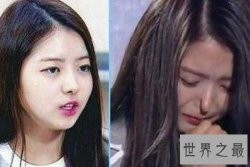 【图】整容失败的明星有哪些 娱乐圈整容堪称家常便饭