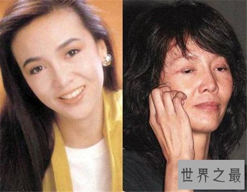 【图】整容失败的明星有哪些 文娱圈整容可谓粗茶淡饭