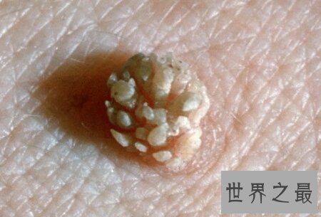 【图】生殖器图片在网上就可有搜到很多 供大家自创