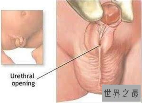 【图】男生殖器日常清洁护理方法 人造生态中酷似生殖