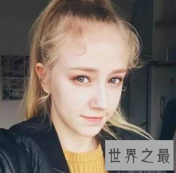 【图】因表面和眼神初中 被中国网友冠之丹麦天使