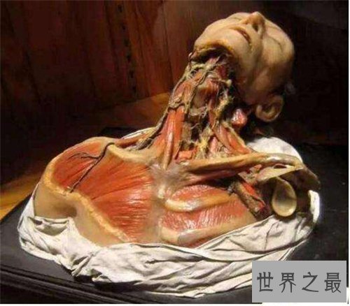 【图】美国费城马特博物馆可谓恐惧地狱 搜集畸形尸体