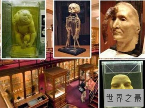 【图】美国费城马特博物馆可谓恐惧地狱 搜集畸形尸体