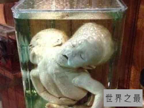 【图】美国费城马特博物馆可谓恐惧地狱 搜集畸形尸体