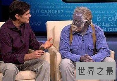 【图】世界第五人种，最奇怪的蓝色人种是切实存在的