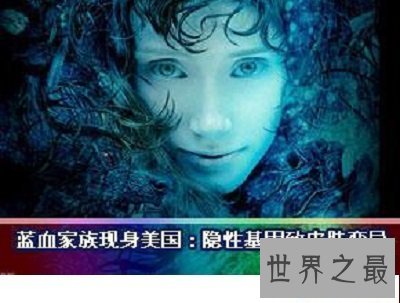 【图】世界第五人种，最奇怪的蓝色人种是切实存在的