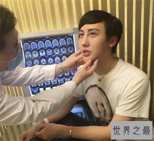 【图】刘梓晨整容公开女友不雅视频 网友取名蛇精男