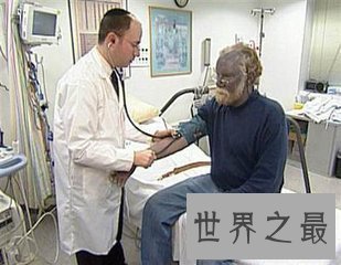 【图】世界上蓝血人的数量是很少的 你知道哪里生存着