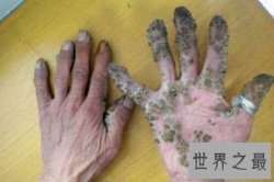 【图】痋术是是一种巫术 也是一种邪术 据说它十分可怕