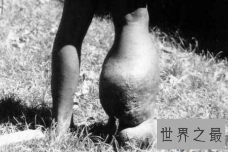 【图】痋术是是一种巫术 也是一种邪术 听说它非常可怕