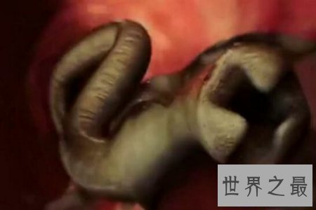 【图】痋术是是一种巫术 也是一种邪术 听说它非常可怕