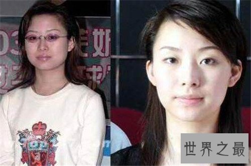 【图】潘晓婷整容对比照 九球天后否认整容风波