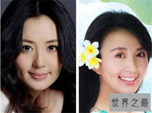 【图】宋林静和杨童舒对比照 于和伟宋林静相爱18年