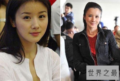 【图】孙菲菲整容前后差别大 孙菲菲踩裙门竟然是她造