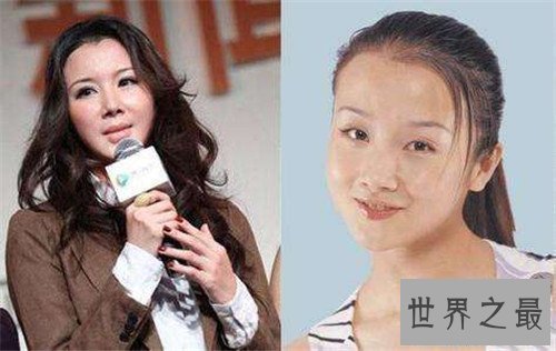 【图】孙菲菲整容前后差别大 孙菲菲踩裙门竟然是她造