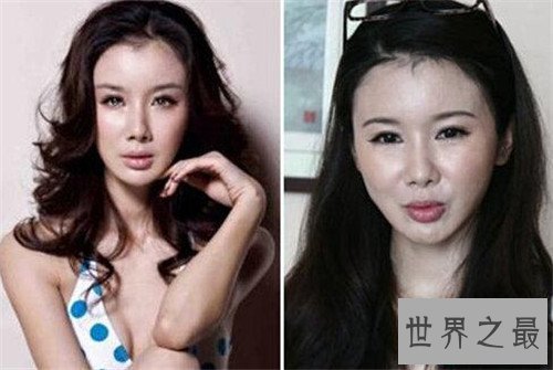 【图】孙菲菲整容前后差别大 孙菲菲踩裙门竟然是她造