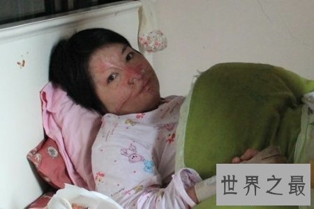 【图】生存中有许多感动人心的故事 让人不由潸然泪下