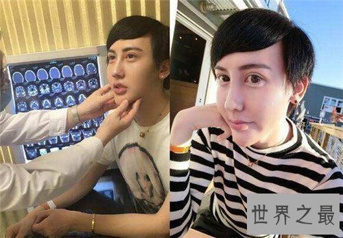 【图】蛇精男刘梓晨走红网络 曝出不雅视频蹭热度