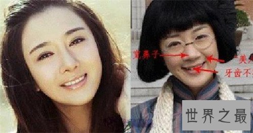 【图】李依晓整容 缘由竟然是被她的狗咬伤