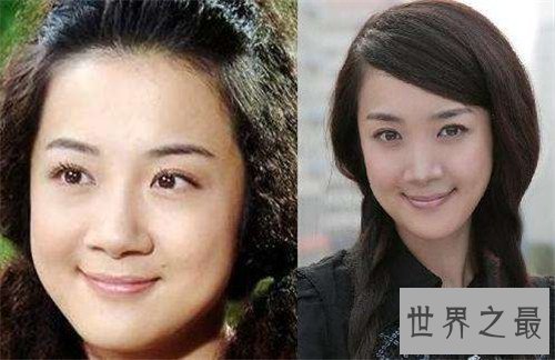 【图】李依晓整容 缘由竟然是被她的狗咬伤