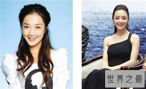 【图】李依晓整容 缘由竟然是被她的狗咬伤