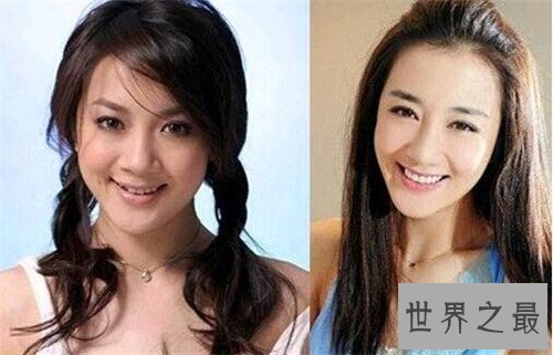 【图】李依晓整容 缘由竟然是被她的狗咬伤