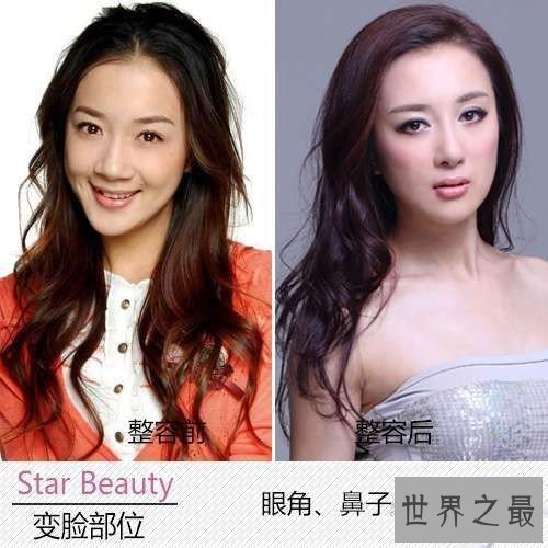 【图】李依晓整容 缘由竟然是被她的狗咬伤