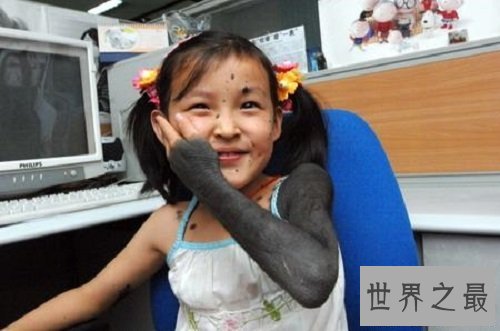 【图】返祖现象再这个世界上还是有很多的 了解返祖