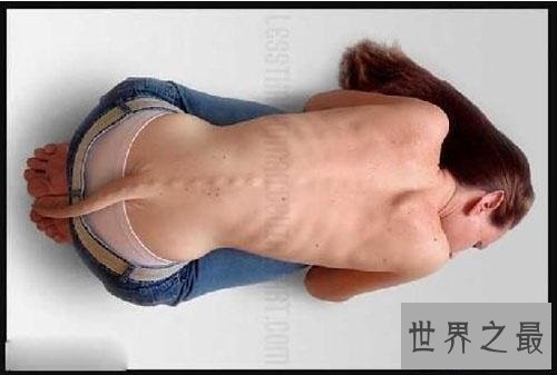 【图】返祖现象再这个世界上还是有很多的 了解返祖