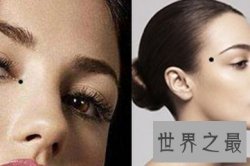 【图】脸上长痣面相图向我们解读了痣的位置的含义