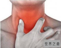 【图】扁桃体发炎的症状，该吃什么药治得好，日常生