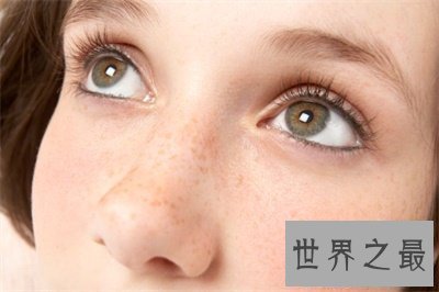 【图】看了黄褐斑图 你还不好好颐养本人的皮肤吗