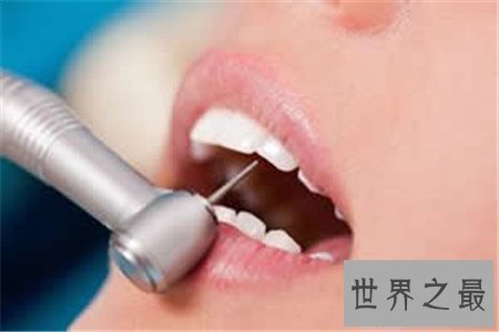 【图】牙龈的可怕惊天大秘密假设你不知道那就太亏了
