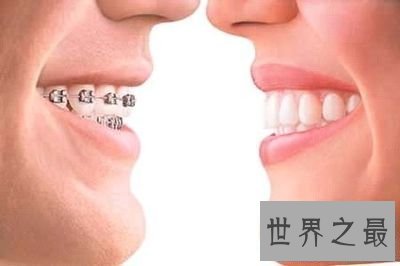 【图】牙龈的可怕惊天大秘密假设你不知道那就太亏了
